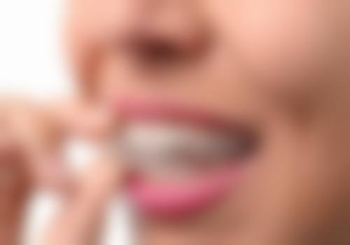 18岁做牙齿矫正的优势
