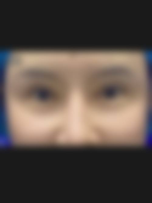 南充康美佳整形医疗美容医院患者口碑评价