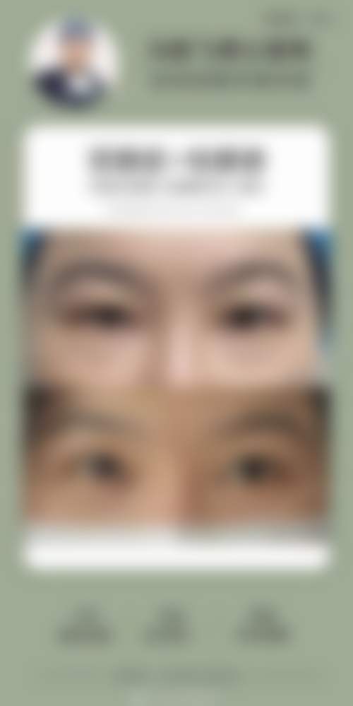 王天天医生技术优势