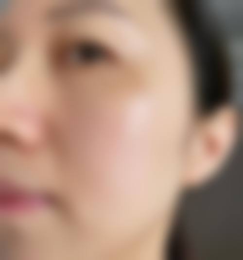 合肥白厦医学美容诊所对应项目说明
