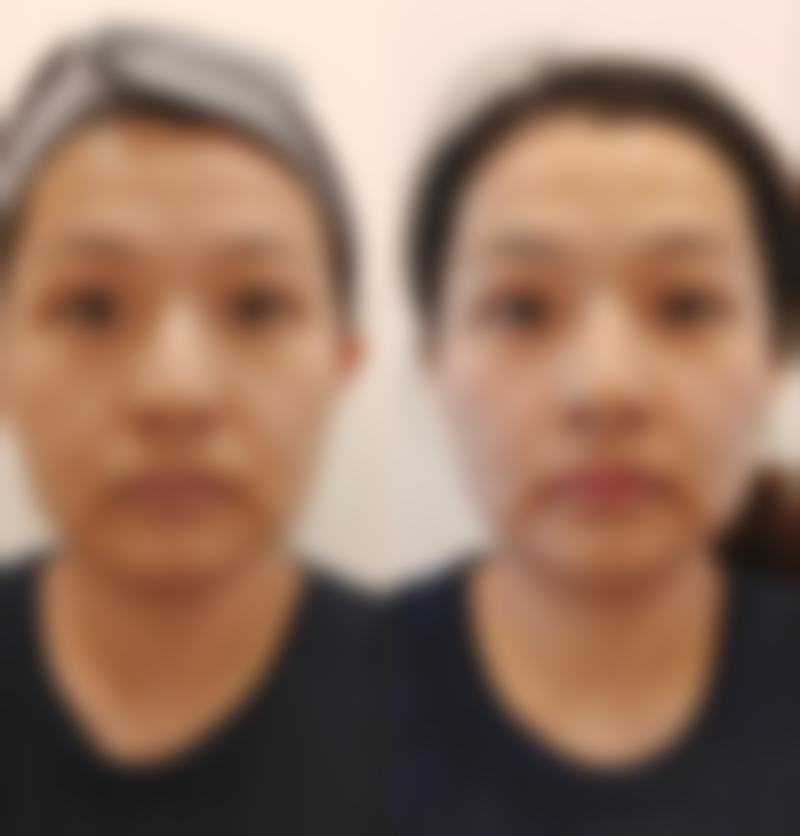 南平武夷山丽姿整形国内外医疗美容医院真人口碑评价怎么样？
