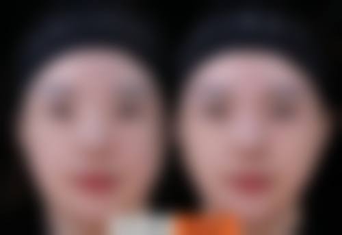 郑萍医生擅长项目