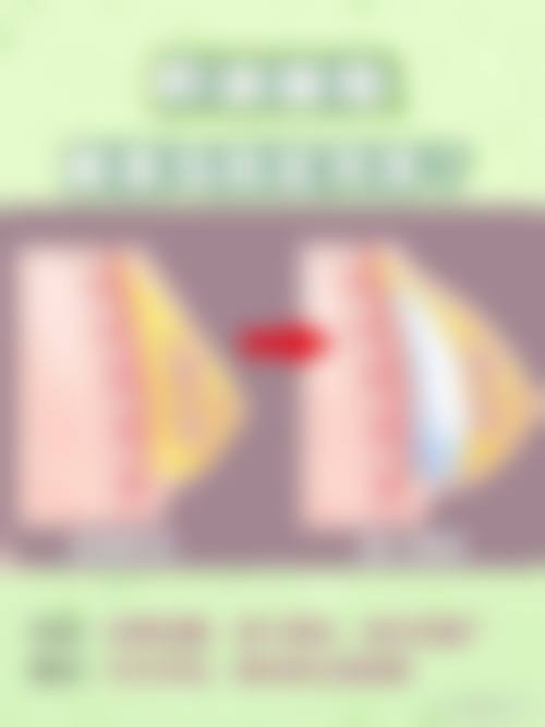 李瑶医生技术优势