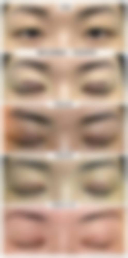 郑萍医生技术特点