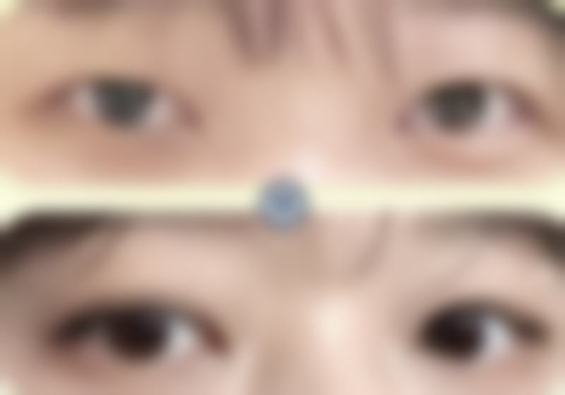 李瑶医生预约挂号
