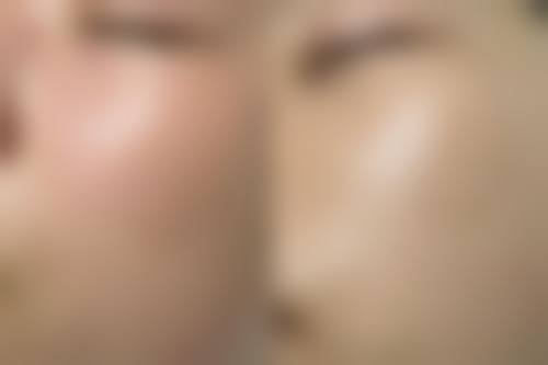 皮肤护理项目