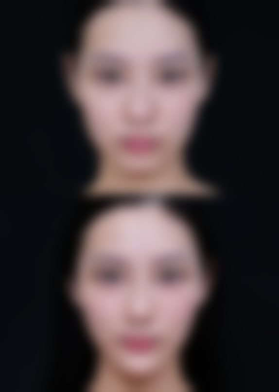 Beauty classic整形医院真实体验