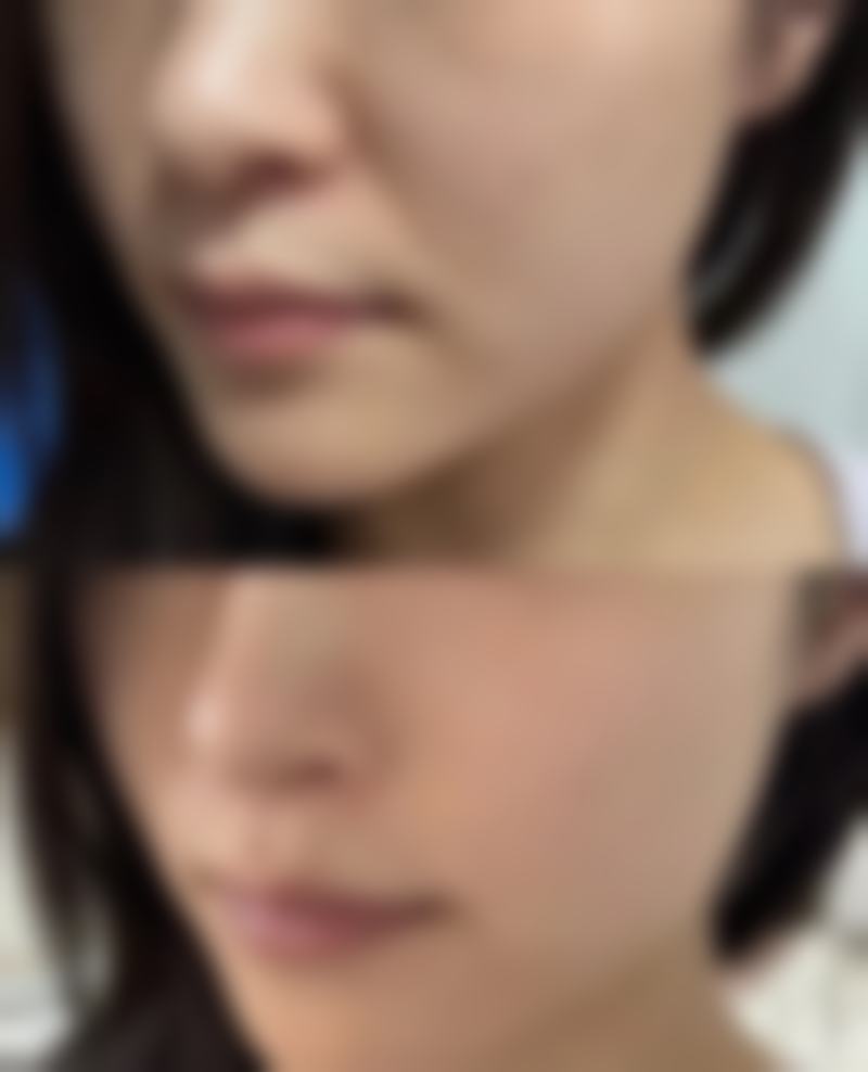 昆山陈医生医疗美容诊所收费价格表