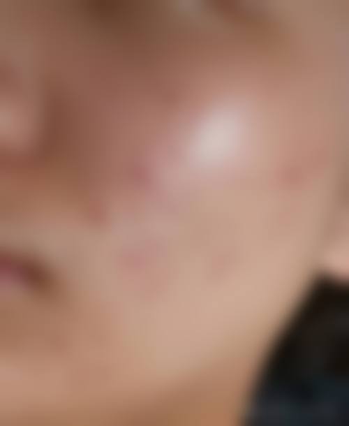彭琬晴医生口碑评价及真人实例
