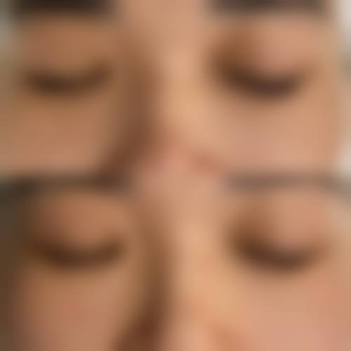 彭琬晴医生预约挂号
