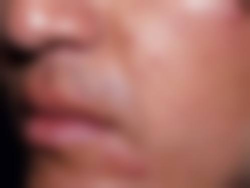 首都医 科 大学附属北京佑安医院皮肤科收费参考