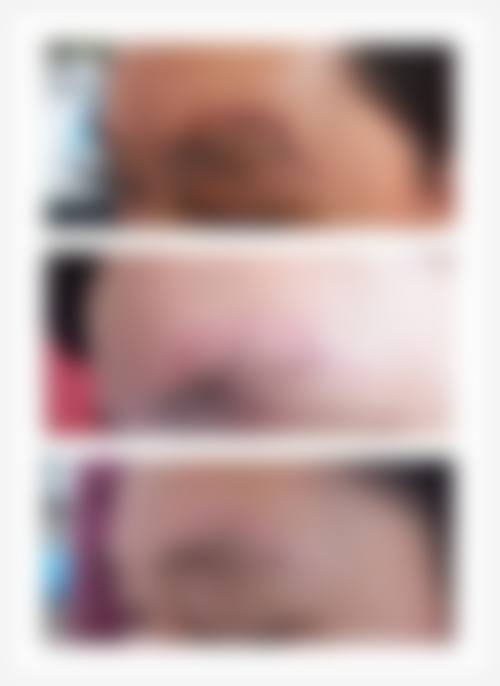 首都医 科 大学附属北京佑安医院皮肤科预约方式