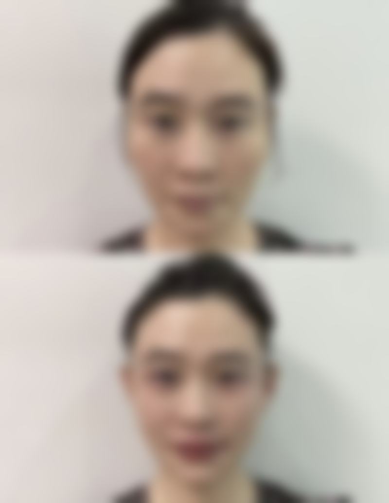 宁波奉化慕圣妃整形医院常见项目收费参考价格表