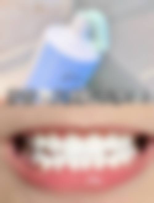 潮州牙齿美白在线咨询24小时，多位专业医生在线答疑，开启牙齿焕白之旅！ 
