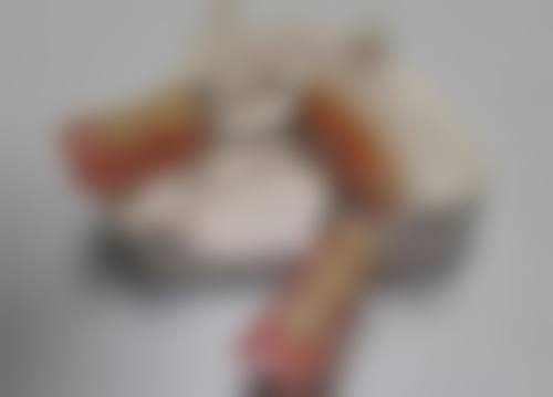 四、无锡佳士洁口腔的威兰德全瓷牙冠，价格优势从何而来？