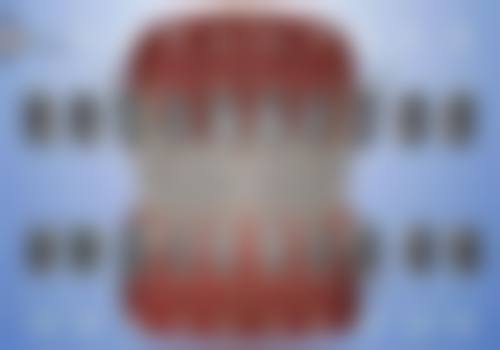 张洁医生口腔项目价格