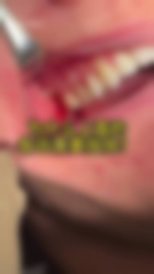 二、药物治疗缓解疼痛有哪些要点？