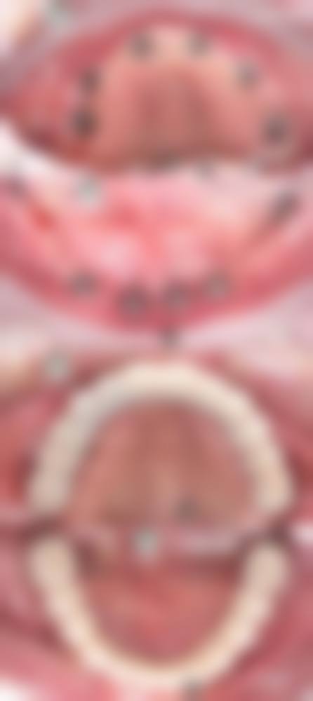 七、长沙正雅口腔门诊部常见问题解答
