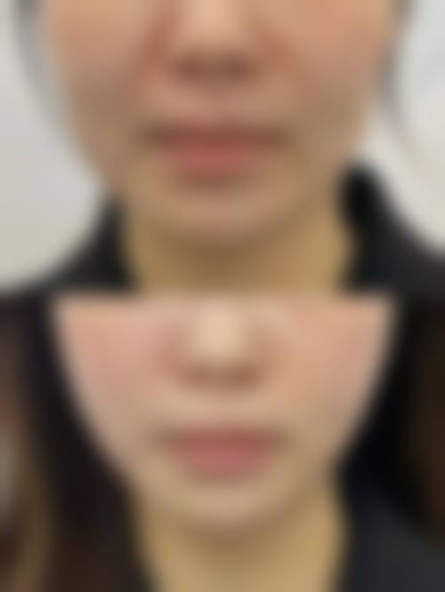 常见问题答疑：解答您的核心疑虑