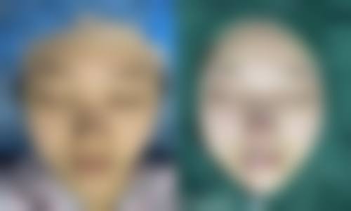 Q:如何选择适合我的医生,比如做私密整形或五官整形?