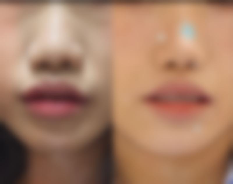 优惠活动与到院指引