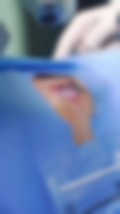 贴心服务与患者保护