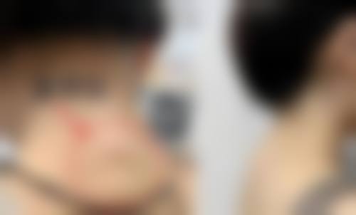 患者真实评价