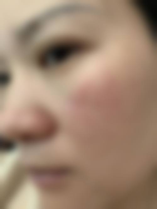 擅长项目详解