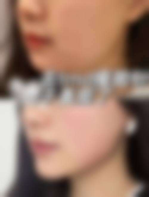精良设备与无菌环境:保护手术质量