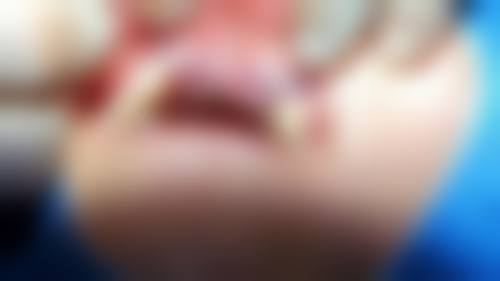 临床实例分享