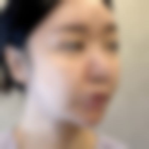 医院优势:韩国TS整形医院的口碑是怎么积累的