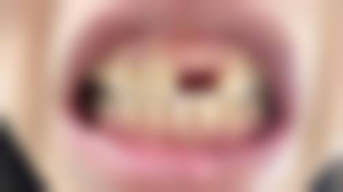 预约优惠活动
