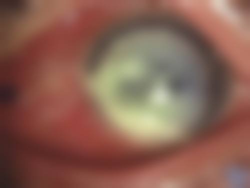 总结:选择昌图县中 心医院眼科,放心看好眼