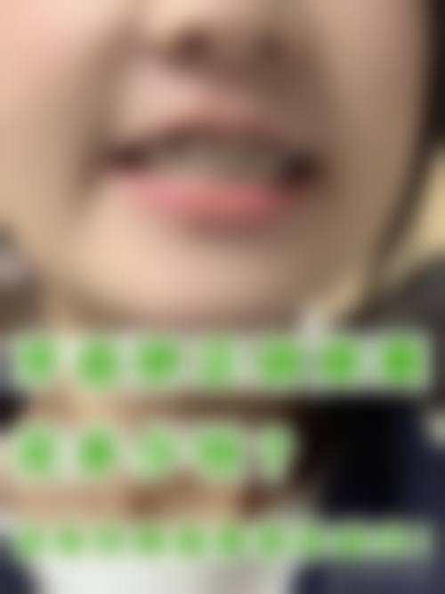 擅长项目详解