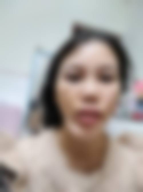 临床实例分享