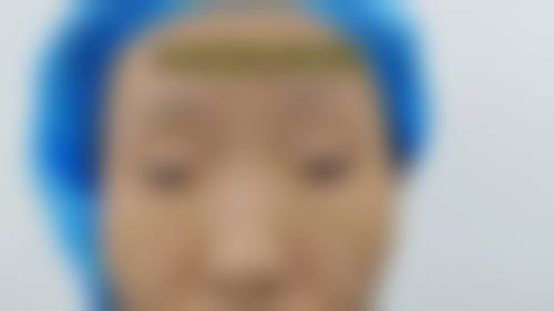 临床实例分享