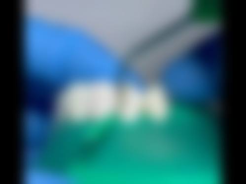 FAQ:常见问题解答
