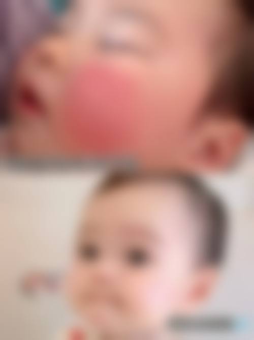 临床实例分享