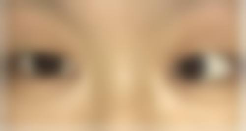 患者真实评价 王鸿雁 眼科 专精