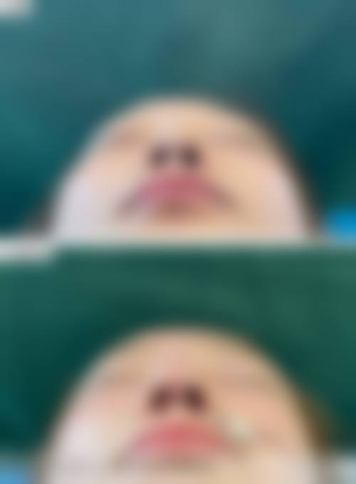 擅长项目详解
