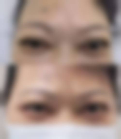 诊疗特色总结 王鸿雁 眼针疗法 修复
