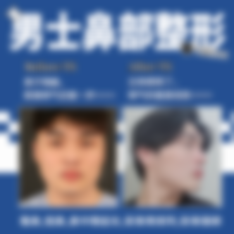 临床实例分享