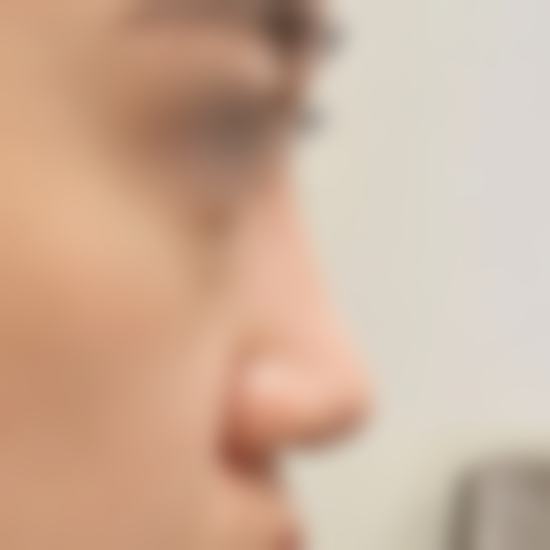 预约优惠活动