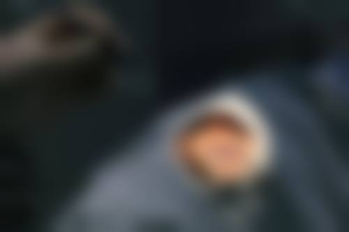 特色技术与项目:白内障手术领跑全盟