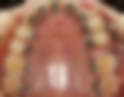 FAQ：解答看牙常见疑问