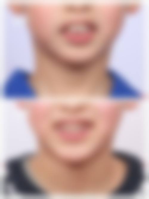 结尾：专精口腔护理从预约开始