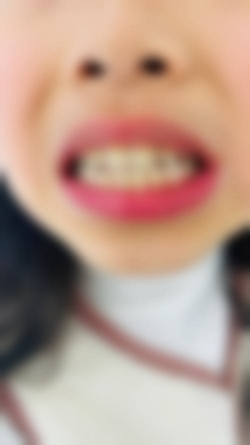 优惠活动详情：限时补贴与透明收费