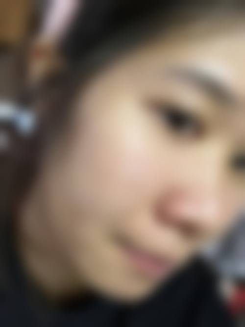 临床实例分享