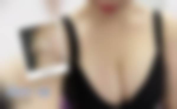 北京禾美嘉医疗美容门诊部的收费贵吗?看看项目价格参考