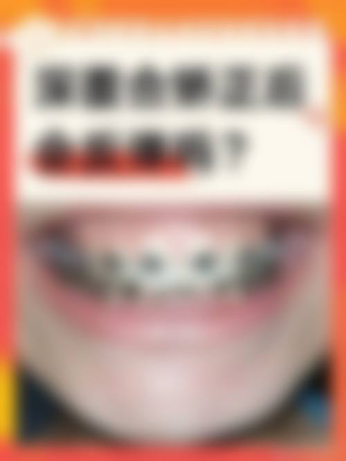 常见问题